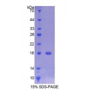 SDS-PAGE analysis of Rat TMEM27 Protein.