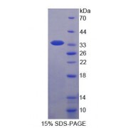 SDS-PAGE analysis of Human WWP2 Protein.