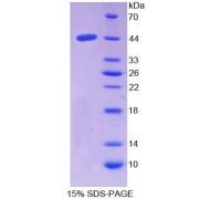 SDS-PAGE analysis of recombinant Human NPC Intracellular Cholesterol Transporter 2 (NPC2) Protein.