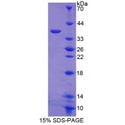 SDS-PAGE analysis of Human ERLIN2 Protein.