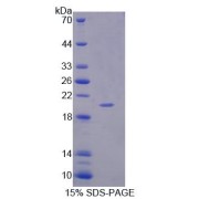 SDS-PAGE analysis of Rat IL1F9 Protein.