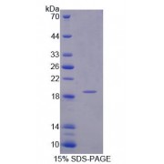 SDS-PAGE analysis of Human INPP4A Protein.