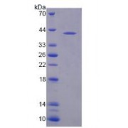 SDS-PAGE analysis of recombinant Human NAT8L Protein.