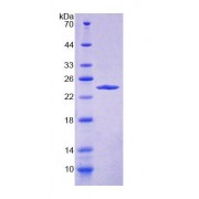 SDS-PAGE analysis of Human DMKN Protein.