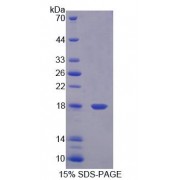 SDS-PAGE analysis of Human ECRG4 Protein.