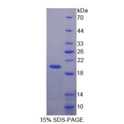 SDS-PAGE analysis of Human BRCC3 Protein.