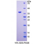 SDS-PAGE analysis of recombinant Human MXRA5 Protein.