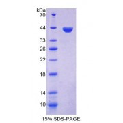 SDS-PAGE analysis of Human KRT33A Protein.