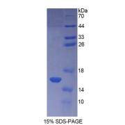 SDS-PAGE analysis of Human CF6 Protein.