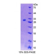 SDS-PAGE analysis of Rat ATP1b4 Protein.