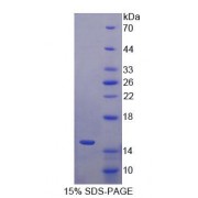 SDS-PAGE analysis of Human S100A15 Protein.