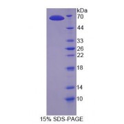 SDS-PAGE analysis of Human DNHD1 Protein.