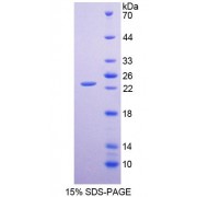 SDS-PAGE analysis of Human CLMP Protein.