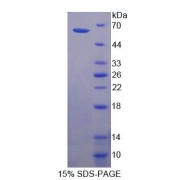 SDS-PAGE analysis of Human CDSN Protein.