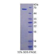 SDS-PAGE analysis of Human CDSN Protein.