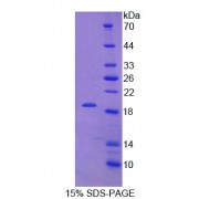 SDS-PAGE analysis of Human KISS1 Protein.