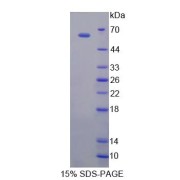 SDS-PAGE analysis of Human EOMES Protein.