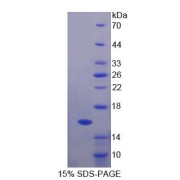 SDS-PAGE analysis of Human FBN1 Protein.