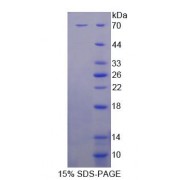 SDS-PAGE analysis of Human VTN Protein.