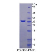 SDS-PAGE analysis of recombinant Human MAGEA1 Protein.