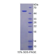 SDS-PAGE analysis of Mouse NCOA6 Protein.