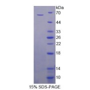 SDS-PAGE analysis of Human CDY1 Protein.