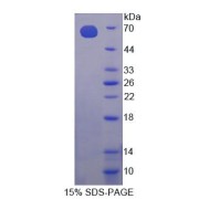 SDS-PAGE analysis of Mouse CHKa Protein.