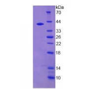 SDS-PAGE analysis of Human DTNBP1 Protein.