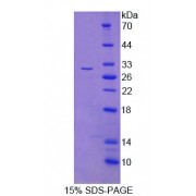 SDS-PAGE analysis of Human FIBP Protein.