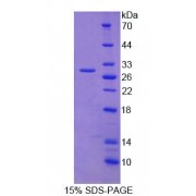 SDS-PAGE analysis of Human NMT2 Protein.