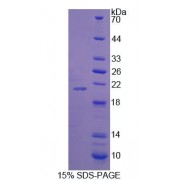 SDS-PAGE analysis of Human SYNPO Protein.