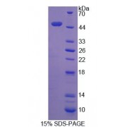 SDS-PAGE analysis of Human DCTN2 Protein.