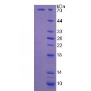 SDS-PAGE analysis of Human CAPN5 Protein.