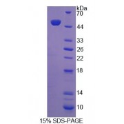 SDS-PAGE analysis of Human ABCA7 Protein.
