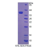 SDS-PAGE analysis of Human COASY Protein.