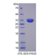 SDS-PAGE analysis of Human SLC22A11 Protein.