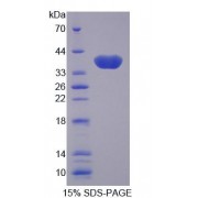 SDS-PAGE analysis of Human OGC Protein.