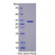 SDS-PAGE analysis of Human Agc1 Protein.