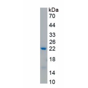 SDS-PAGE analysis of recombinant Human General Transcription and DNA Repair Factor IIH Helicase Subunit XPB (ERCC3) Protein.