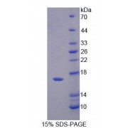 SDS-PAGE analysis of Human PFN4 Protein.