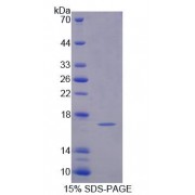 SDS-PAGE analysis of Mouse PFN4 Protein.