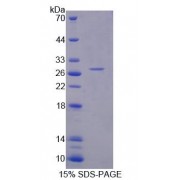 SDS-PAGE analysis of Human RFC5 Protein.