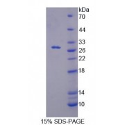 SDS-PAGE analysis of Mouse RFC5 Protein.