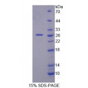 SDS-PAGE analysis of recombinant Human RFC4 Protein.