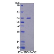 SDS-PAGE analysis of recombinant Human MED6 Protein.