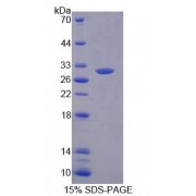 SDS-PAGE analysis of Human MED8 Protein.