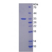 SDS-PAGE analysis of Human SF3B1 Protein.