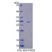 SDS-PAGE analysis of Human USP2 Protein.