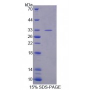 SDS-PAGE analysis of Human XPO4 Protein.