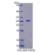 abx650938